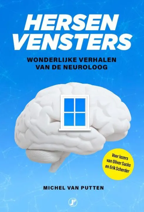 Hersenvensters